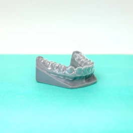 Clinique cabinet gouttières - Traitements orthodontiques personnalisés 