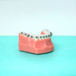 Clinique cabinet brackets fixe - Traitements orthodontiques personnalisés 